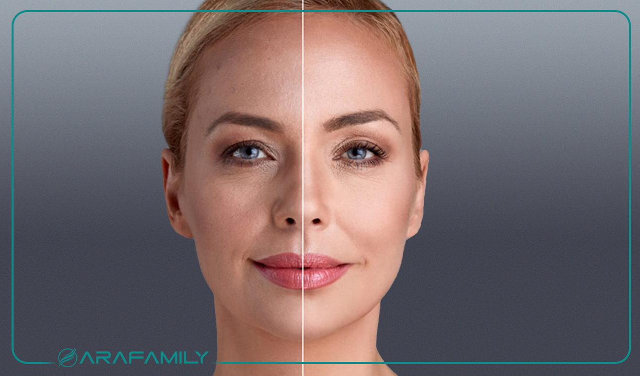 چین و چروک: شناخت، علل و روش های درمان